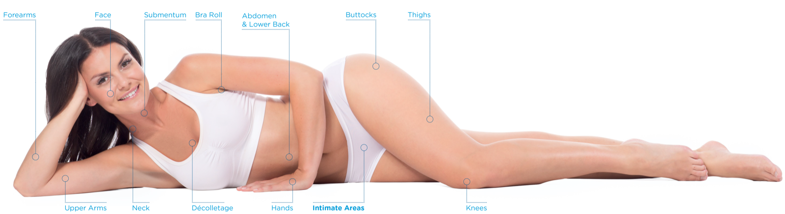 Exilis Ultra 360 – kezelhető testterületek